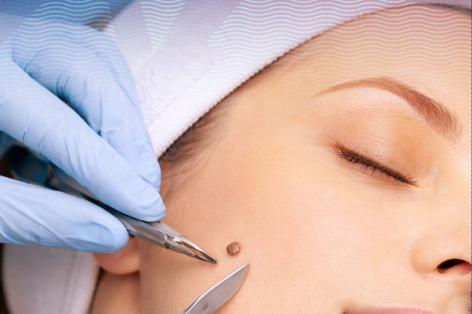 fast home delivery burger social media instagram story template