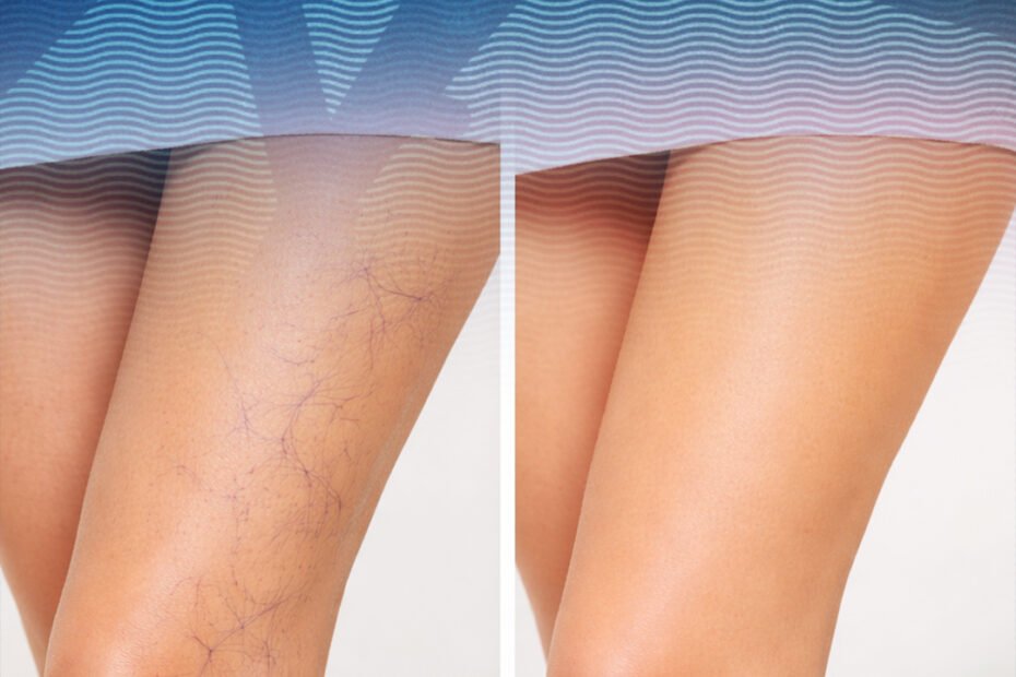 fast home delivery burger social media instagram story template